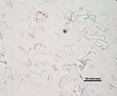Struvite crystals in dog bladder infection